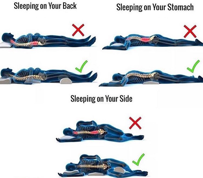 How To Sleep With Back Pain - All Star Chiropractic